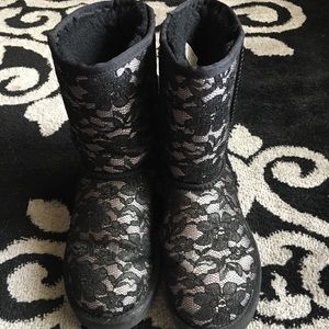 Lace Uggs